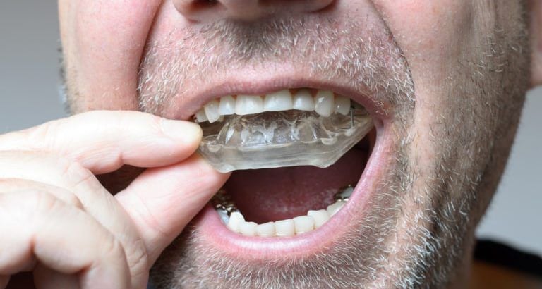 a person inserting night guard in mouth