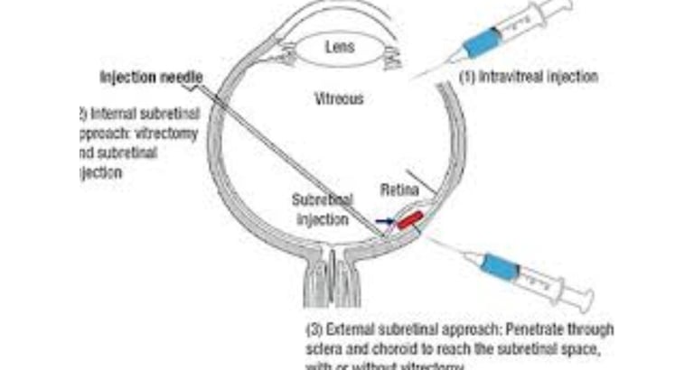 Retinitis Pigmentosa Fasting, Autophagy, Stem Cells, and Emerging Therapies
