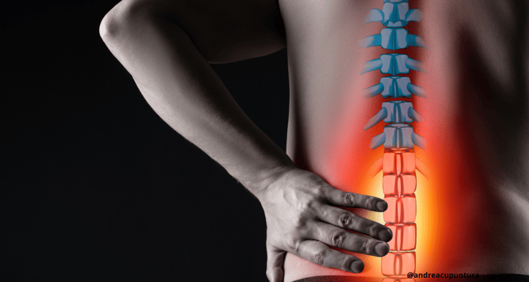 dor lombar, lombalgia, ciático, acupuntura