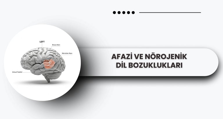 Afazi ve nörojenik dil bozukluklarını temsil eden beyin modeli.