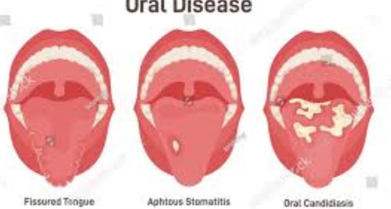 stomatitis