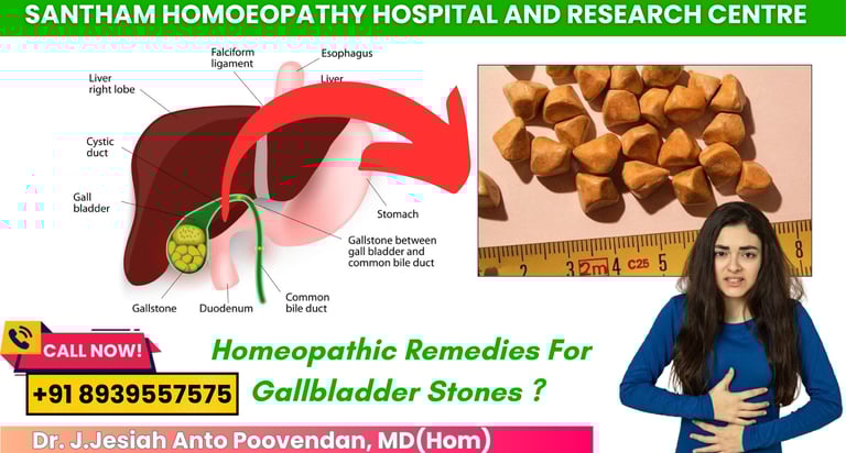 Homeopathy treatment for gallstones in Chennai