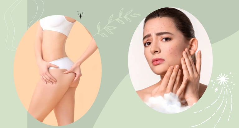 Woman checking her facial acne and person touching smooth skin for beauty and skincare treatment.