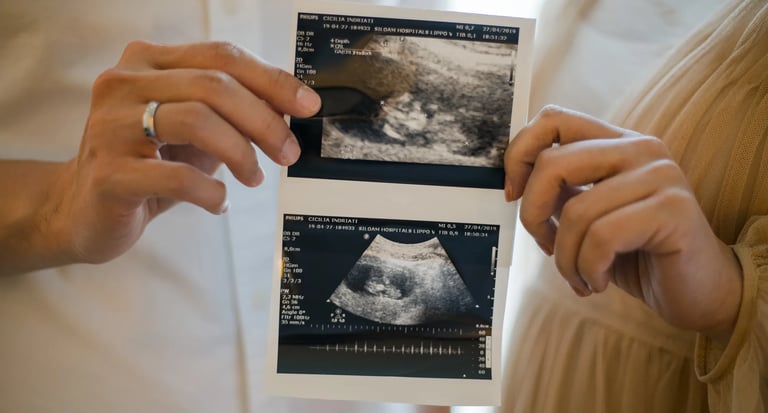 Parents holding ultrasound photos during a babymoon photography session at The Apurva Kempinski Bali