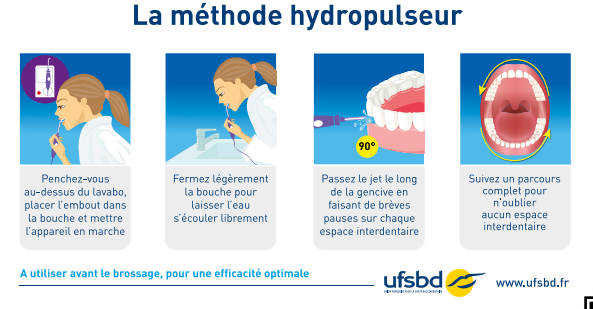 Méthode utlilisation hydropulseur, jet dentaire selon UFSBD