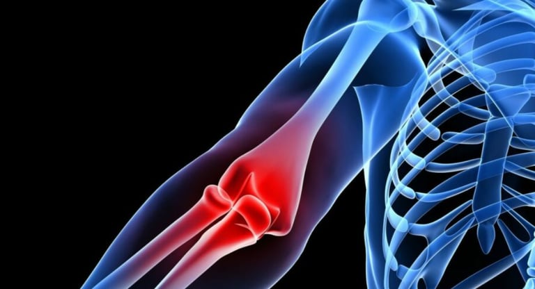 a person with a painful elbow