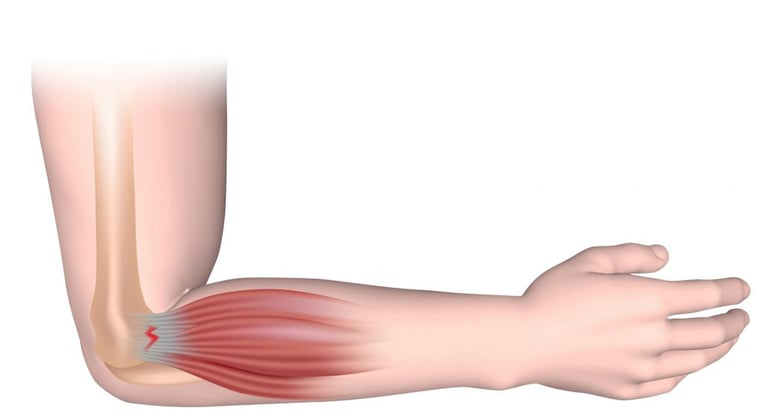 Dr.Rajinikanth's ortho clinic tennis elbow