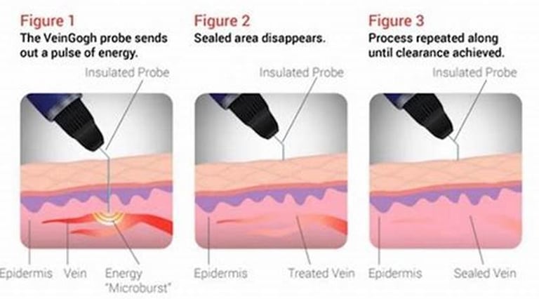 Veingogh by Dr. Omar Hamdallah