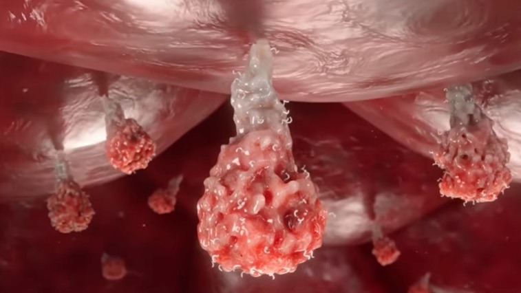 Spike proteins appearing on body cells.