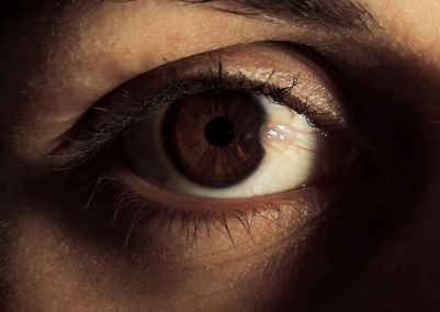 pterygium