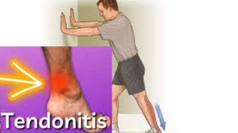 achilles tendon