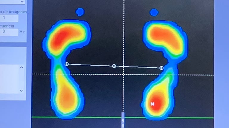 estudio biomecánica Podocenter