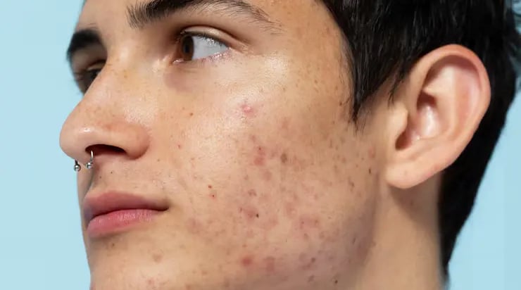 a man with a piercing on his nose and nose piercings