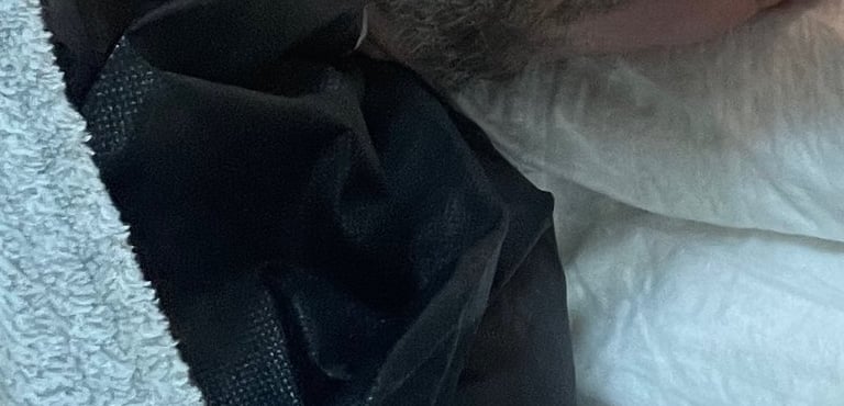 a hair transplant taking place in turkey