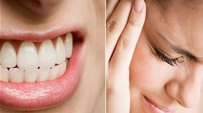 Tratamiento médico para bruxismo y perfilado facial en AR Clinic