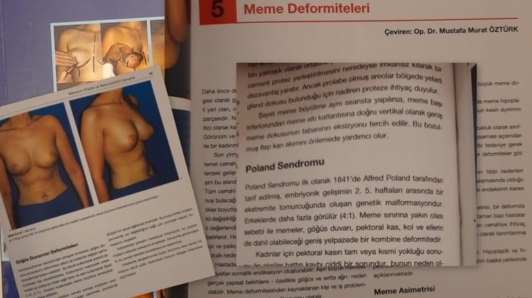 Meme Estetik ve Rekonstrüktif Cerrahi Kitabı, Poland Sendromu, Tübüler meme, Tüberoz meme