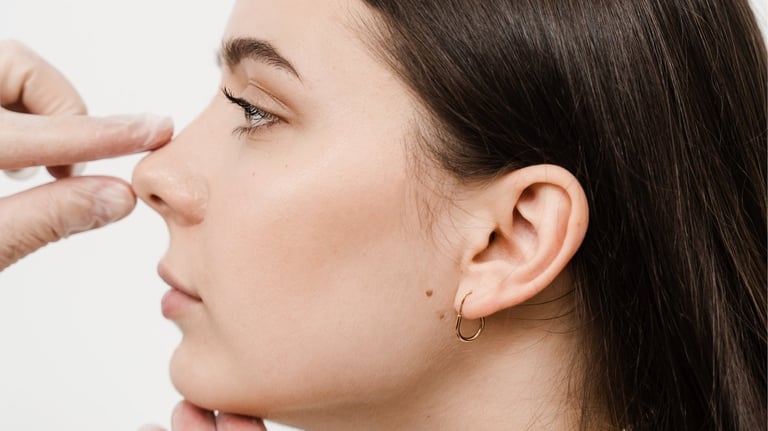 Dra. Lilyan Marissel - Cirugía Plástica y Estética - rinoplastia