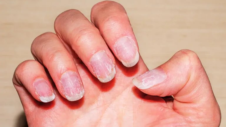 a person's hand holding a piece of nail polish