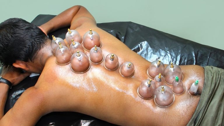 cupping therapy for back pain relief by certified physiotherapist at home 