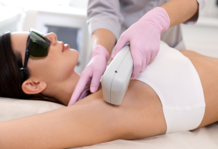 depilacion definitiva