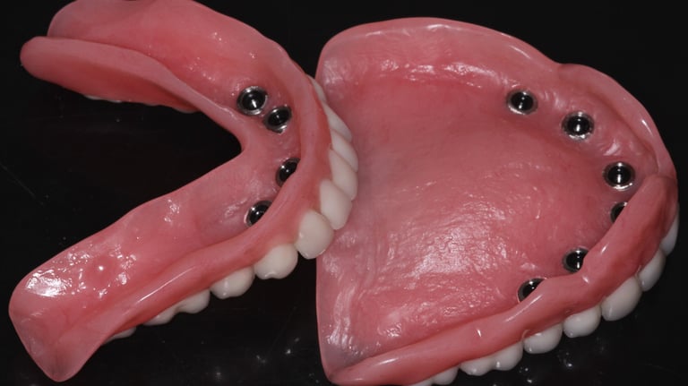 a image showing implant dentures