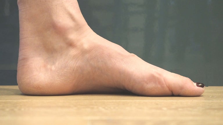 image of a high arch