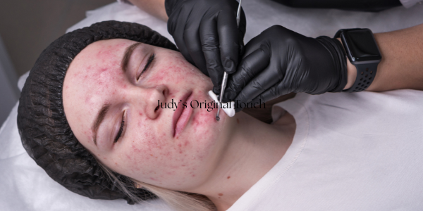 a woman getting a facial lift from an esthetician