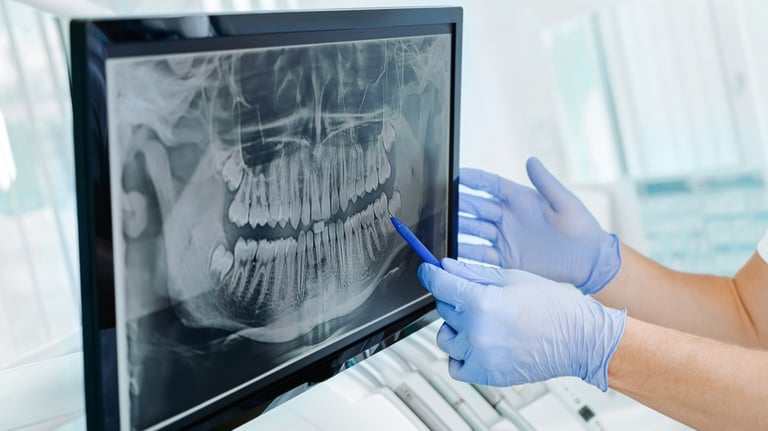 Early detection through routine oral cancer screenings