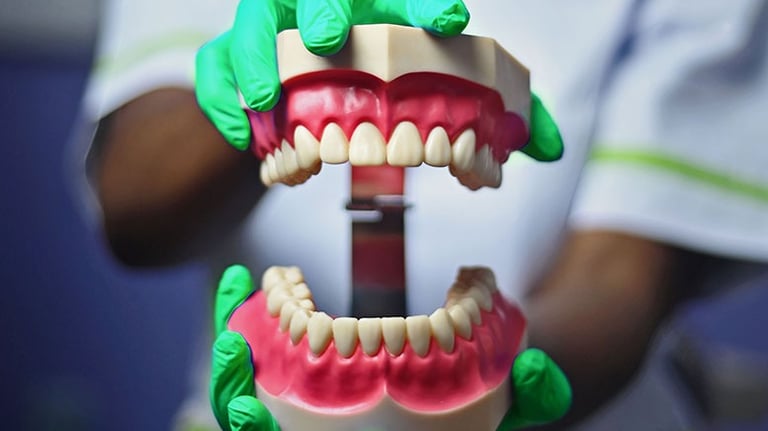 Dentiste tenant un modèle de mâchoire pour l'éducation à l'hygiène buccale à Mokolo