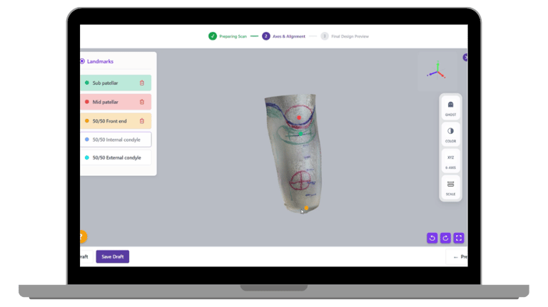 BenX 3D prosthetic socket design software