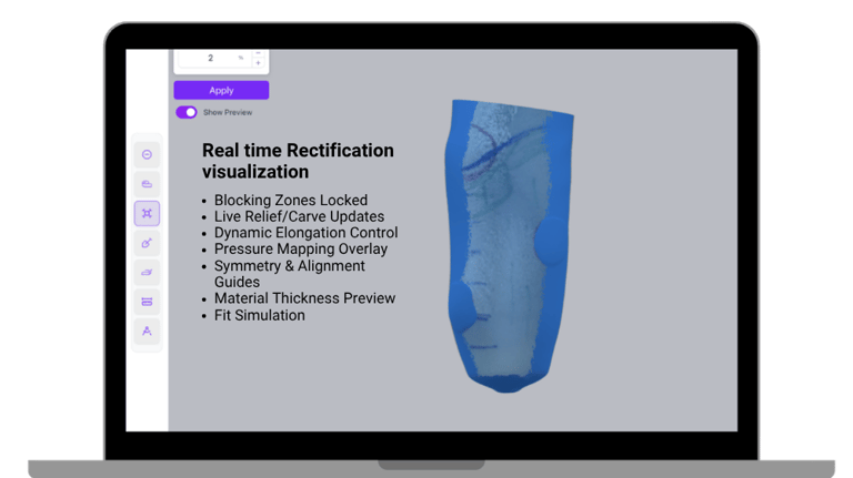 BenX modern orthotics and prosthetics software