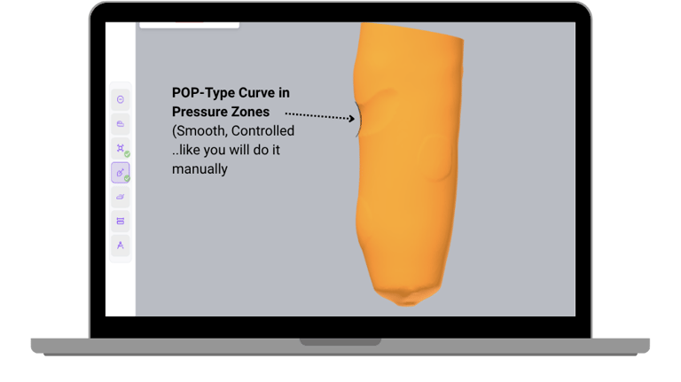BenX patient-focused prosthetic design software