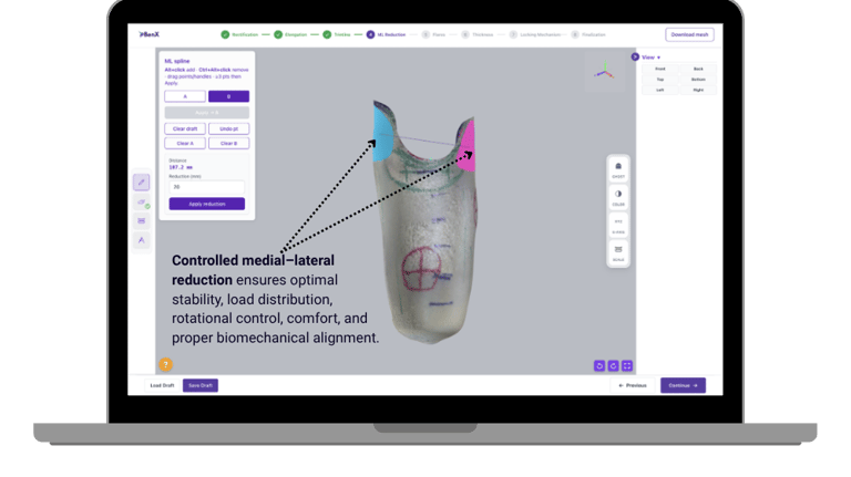 BenX intelligent O&P design automation platform