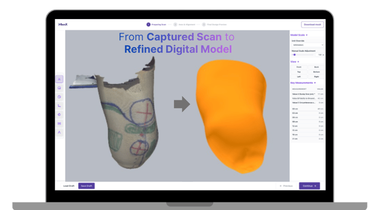 BenX prosthetic CAD modeling software