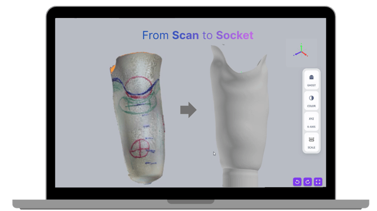 BenX advanced prosthetic workflow studio
