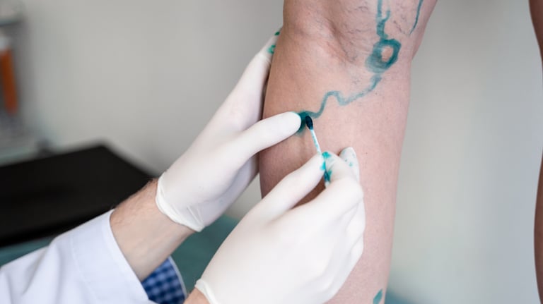 Vascular Surgery at Bone Care One Day Surgery Center in Abu Dhabi