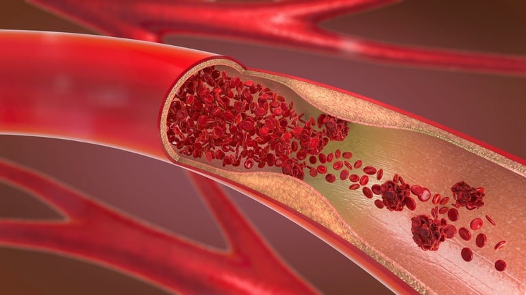 Peripheral Vascular Disease in Amman Jordan