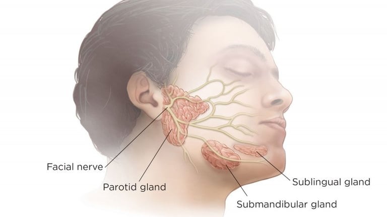 παρωτίδα λίθος σιελόγόνοι αδένες