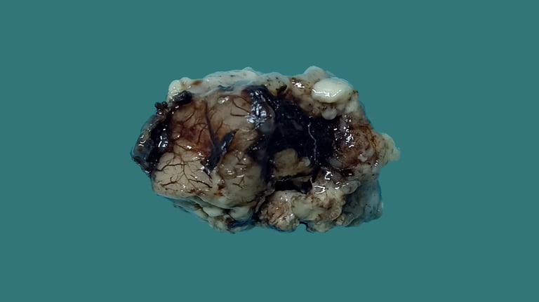 anatomía patológica neuropatología