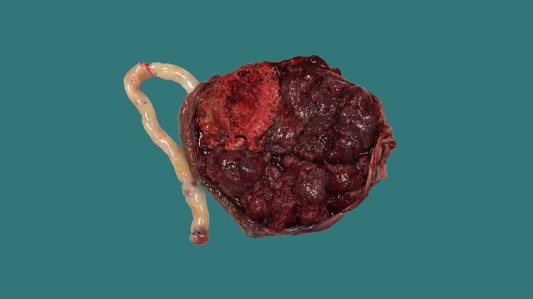 anatomía patológica obstetricia y ginecología