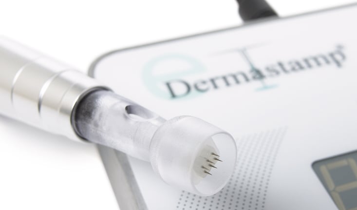 micro-needling microneedling pores
