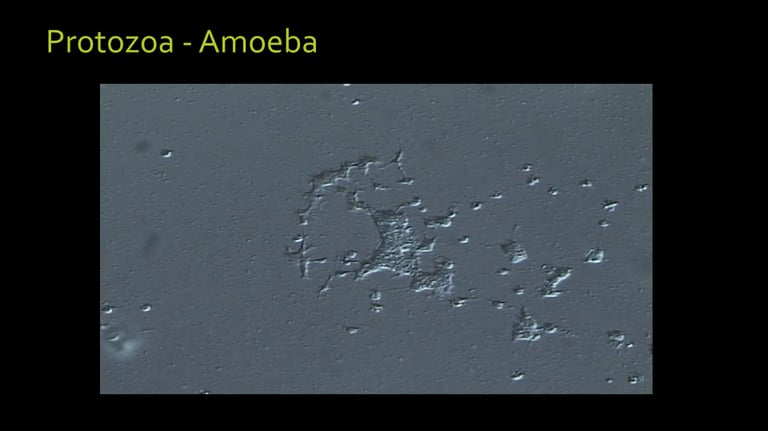 microscope image of a living Soil Amoeba