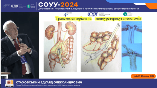 conference urology kyiv, professor stakhovsky eduard, urolog, oncolog, kyiv, ukraine