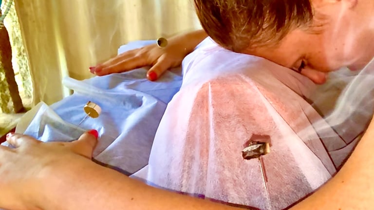 a picture of Alena Booth, founded of Grateful Minds doing acupunture in India