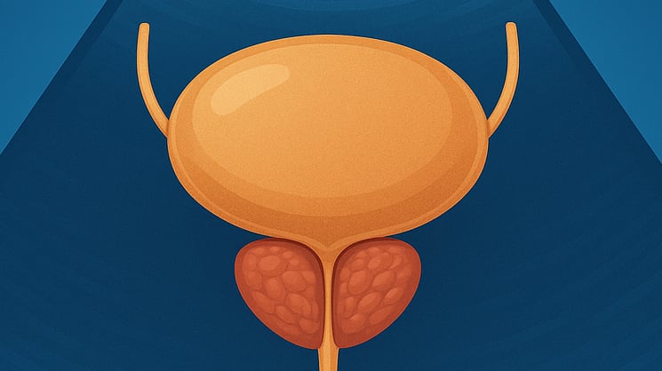 Ecografia vescico-prostatica Qualiano - Esame prostata e vescica Dott. Picascia