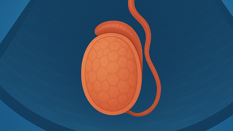 Ecografia testicolare Qualiano - Esame scrotale specialistico Dott. Picascia