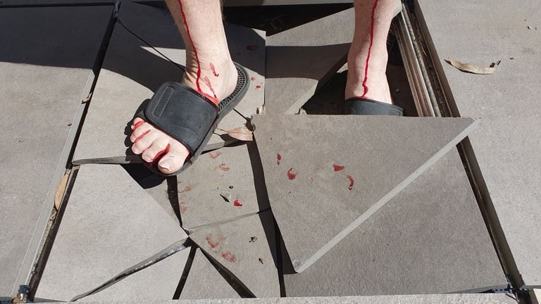 Injury caused by pedestal tile breaking