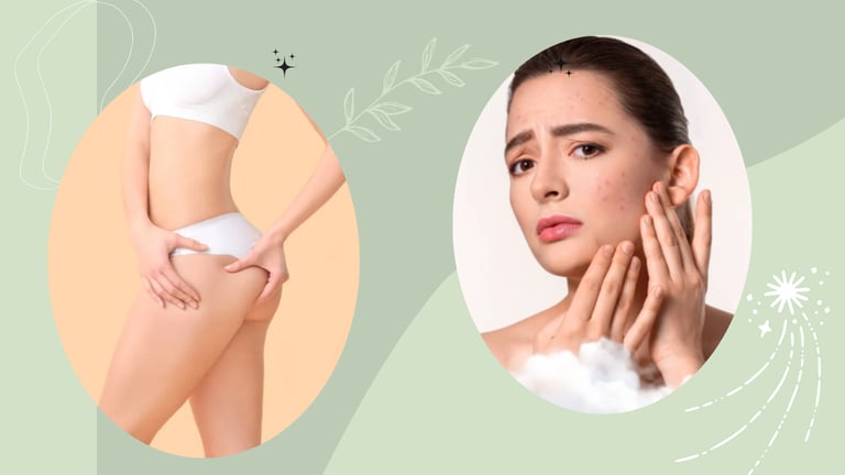 Woman checking her facial acne and person touching smooth skin for beauty and skincare treatment.