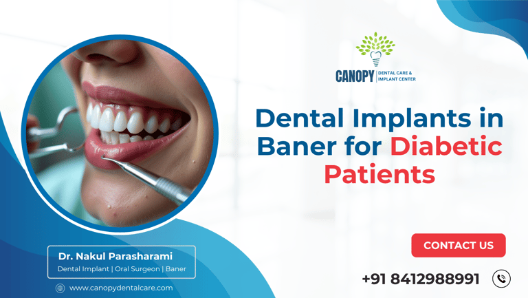 Dental Implant in Baner