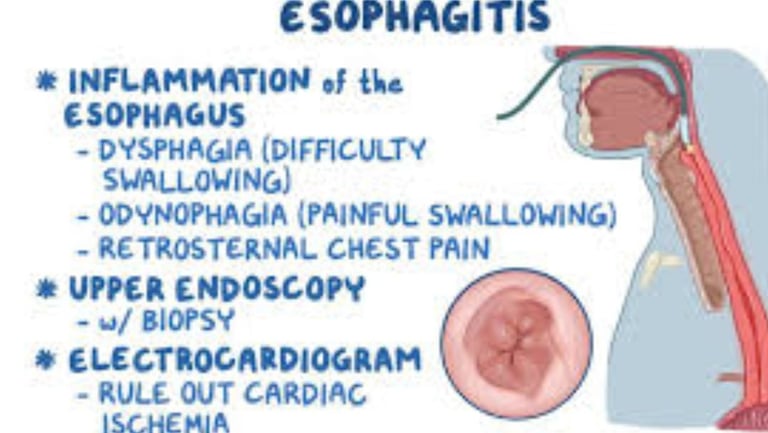 esophagitis